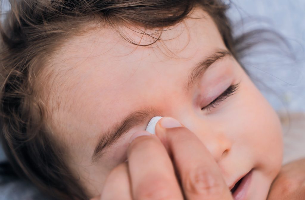 A person uses a soft cloth to wipe their baby's swollen eye.